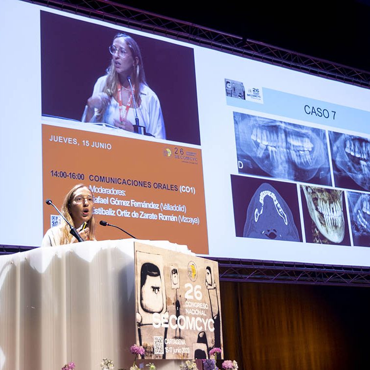 CONGRESO DE LA SOCIEDAD ESPAÑOLA DE CIRUGÍA ORAL Y MAXILOFACIAL Y DE CABEZA Y CUELLO EL BATEL CARTAGENA